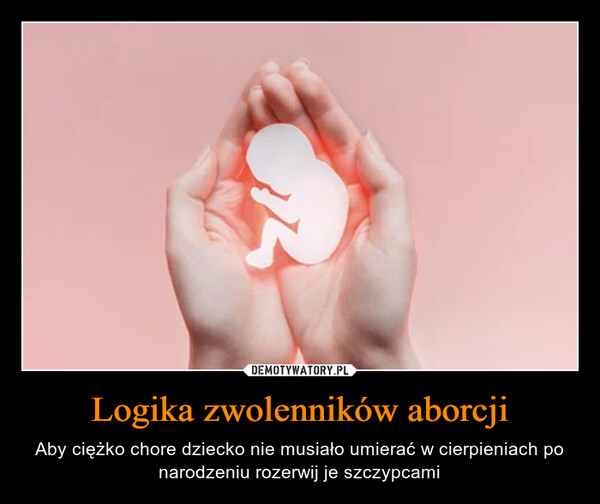Logika zwolenników aborcji – Aby ciężko chore dziecko nie musiało umierać w cierpieniach po narodzeniu rozerwij je szczypcami 
